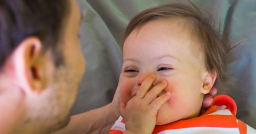 Understanding cognitive delays in infants with Down syndrome